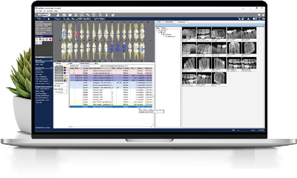 dental practice management software