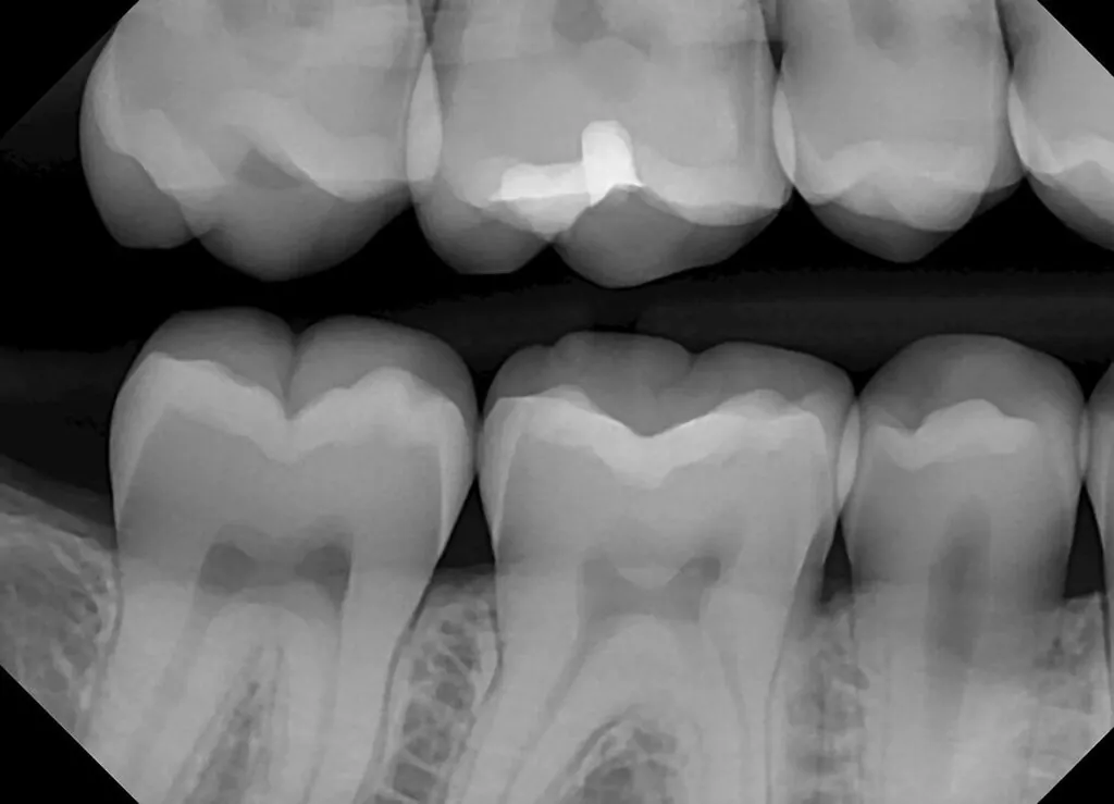 dream sensor x-ray 2